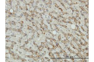 Immunoperoxidase of monoclonal antibody to TYR on formalin-fixed paraffin-embedded human liver tissue.