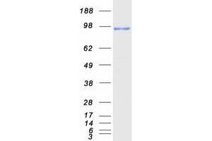 Validation with Western Blot