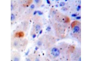 Used in DAB staining on fromalin fixed paraffin-embedded Liver tissue (FAS anticorps  (AA 188-319))