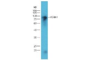 Lane 1: mouse heart lysates probed with Rabbit Anti-VCAM1 Polyclonal Antibody, Unconjugated  at 1:5000 for 90 min at 37˚C. (VCAM1 anticorps  (AA 651-739))