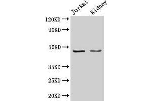 Western Blot Positive WB detected in: Jurkat whole cell lysate, Rat kidney tissue All lanes: ALDOA antibody at 3 μg/mL Secondary Goat polyclonal to rabbit IgG at 1/50000 dilution Predicted band size: 40, 46 kDa Observed band size: 46 kDa (ALDOA anticorps  (AA 2-364))