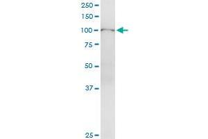 Immunoprecipitation of HSPA4 transfected lysate using anti-HSPA4 MaxPab rabbit polyclonal antibody and Protein A Magnetic Bead , and immunoblotted with HSPA4 purified MaxPab mouse polyclonal antibody (B02P) .