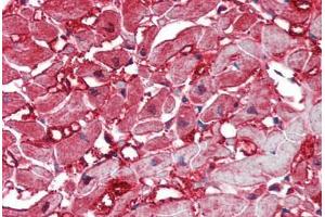 Human Heart: Formalin-Fixed, Paraffin-Embedded (FFPE) (Caspase 12 anticorps)