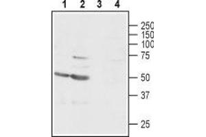 Western blot analysis of rat (lanes 1 and 3) and mouse (lanes 2 and 4) brain lysates: - 1,2. (GABRg1 anticorps  (C-Term, Intracellular))