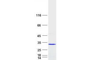 Validation with Western Blot