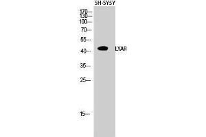 Western Blot (WB) analysis of SH-SY5Y cells using LYAR Polyclonal Antibody. (LYAR anticorps  (Internal Region))