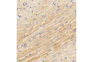 Immunohistochemistry analysis of paraffin embedded mouse heart using PDK3 (ABIN7075334) at dilution of 1: 2000 (PDK3 anticorps)