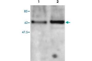 Western blot was performed on nuclear extracts from mouse fibroblastst (NIH/3T3) and embryonic stem cells (E14Tg2a) with Mbd2 polyclonal antibody , diluted 1 : 500 in BSA/PBS-Tween. (MBD2 anticorps)