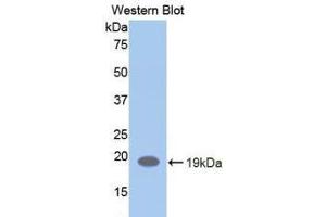 Western blot analysis of the recombinant protein. (LIFR anticorps  (AA 692-833))