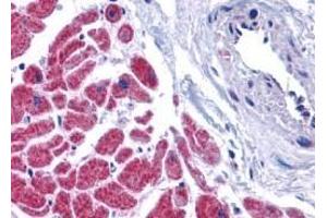 Immunohistochemistry of caspase-12 in human heart tissue with caspase-12 antibody at 10 μg/ml.
