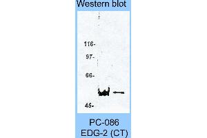 Image no. 1 for anti-Lysophosphatidic Acid Receptor 1 (LPAR1) (C-Term) antibody (ABIN187787)