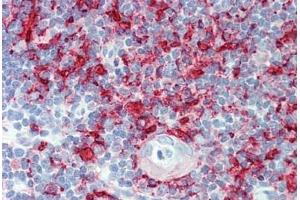 Human Thymus: Formalin-Fixed, Paraffin-Embedded (FFPE) (MHC Class II HLA-DP/DQ/DR anticorps)