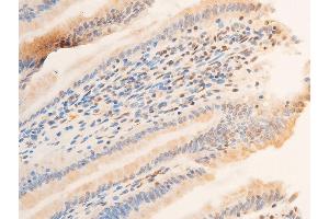 ABIN6267218 at 1/100 staining rat intestinal tissue sections by IHC-P.