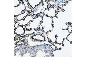 Immunohistochemistry of paraffin-embedded mouse lung using  Rabbit pAb (ABIN3016739, ABIN3016740, ABIN3016741, ABIN1678526 and ABIN6219830) at dilution of 1:100 (40x lens).