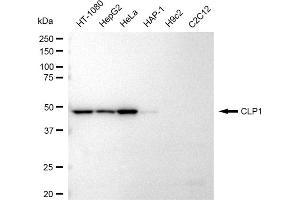 Western blotting analysis using CLP1 antibody (ABIN7798094).
