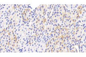Detection of PLCd4 in Human Kidney Tissue using Polyclonal Antibody to Phospholipase C Delta 4 (PLCd4)
