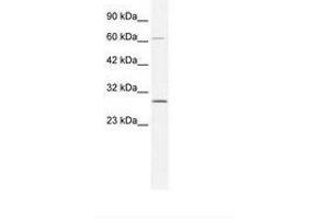 Image no. 1 for anti-Poly (ADP-Ribose) Polymerase Family, Member 11 (PARP11) (AA 112-161) antibody (ABIN202264) (PARP11 anticorps  (AA 112-161))