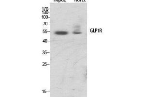 Western Blot (WB) analysis of specific cells using GLP-1R Polyclonal Antibody.