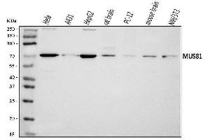 Western blot analysis of MUS81 using anti-MUS81 antibody (ABIN7601094).