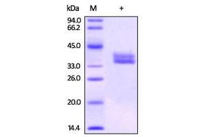 Biotinylated Human GPA33 on SDS-PAGE under reducing (R) condition.