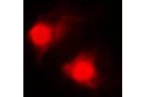Immunofluorescent analysis of RAR beta staining in MDAMB435 cells. (Retinoic Acid Receptor beta anticorps  (C-Term))