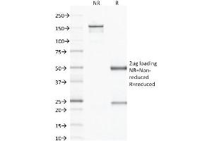 SDS-PAGE Analysis Purified Factor XIIIa Mouse Monoclonal Antibody (F13A1/1683). (F13A1 anticorps  (AA 46-181))