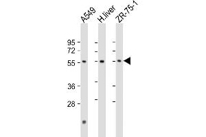 All lanes : Anti-D1 Antibody (N-Term) at 1:2000 dilution Lane 1: A549 whole cell lysate Lane 2: human liver lysate Lane 3: ZR-75-1 whole cell lysate Lysates/proteins at 20 μg per lane.