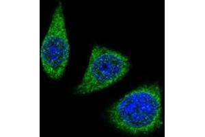 Confocal immunofluorescent analysis of MMP7 antibody with 293 cells followed by Alexa Fluor 488-conjugated goat rabbit lgG (green).