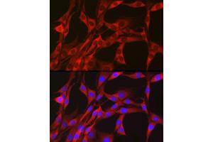 Immunofluorescence analysis of PC-12 cells using PGD Rabbit pAb (ABIN6127314, ABIN6145502, ABIN6145503 and ABIN6223639) at dilution of 1:50 (40x lens).