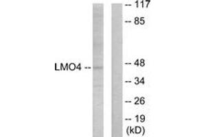 Western Blotting (WB) image for anti-LIM Domain Only 4 (LMO4) (AA 116-165) antibody (ABIN2889531) (LMO4 anticorps  (AA 116-165))