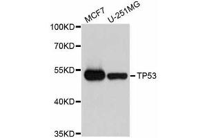 Western blot analysis of extracts of various cell lines, using TP53 antibody. (p53 anticorps  (AA 1-110))