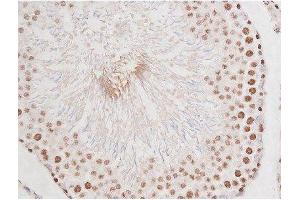 ABIN6267354 at 1/200 staining Rat testis tissue sections by IHC-P.