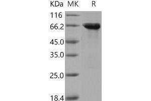 Western Blotting (WB) image for Serine/threonine-Protein Kinase MST4 (MST4) (Active) protein (GST tag) (ABIN7317098)