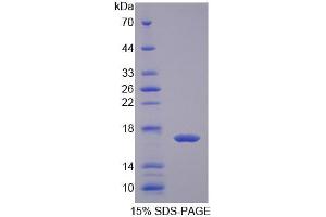 SDS-PAGE analysis of Cow FABP2 Protein. (FABP2 Protéine)