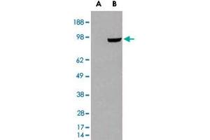 HEK293 overexpressing PDE5A and probed with PDE5A polyclonal antibody  (mock transfection in first lane), tested by Origene. (PDE5A anticorps)