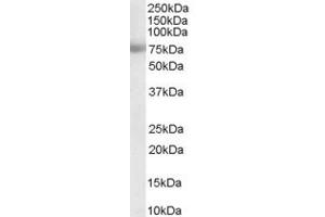 ABIN184623 staining (0. (MTA1 anticorps  (Internal Region))
