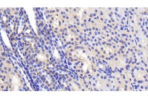 Detection of SPTAN1 in Human Kidney Tissue using Polyclonal Antibody to Alpha-Fodrin (SPTAN1) (SPTAN1 anticorps  (AA 1573-1742))