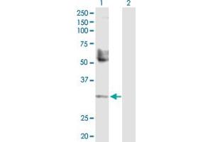 Western Blot analysis of TREX1 expression in transfected 293T cell line by TREX1 MaxPab polyclonal antibody. (TREX1 anticorps  (AA 1-304))