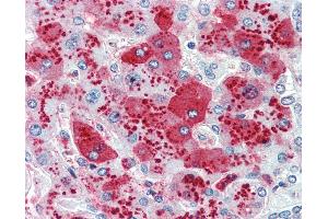 Anti-CDCP1 antibody IHC of human liver. (CDCP1 anticorps  (Internal Region))