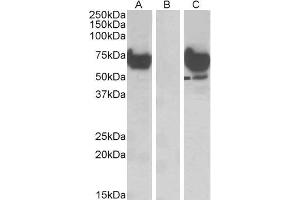HEK293 lysate (10ug protein in RIPA buffer) overexpressing Human EPM2AIP1 with DYKDDDDK tag probed with ABIN5539636 (1ug/ml) in Lane A and probed with anti-DYKDDDDK Tag (1/1000) in lane C. (EPM2AIP1 anticorps  (Internal Region))