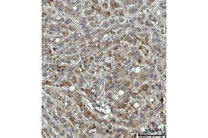 IHC analysis of THBS3 using anti-THBS3 antibody (ABIN7600759).