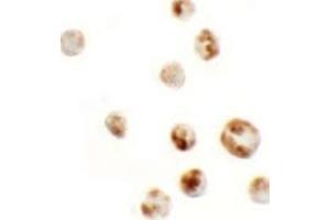 Immunohistochemistry (IHC) image for anti-Actin Filament Associated Protein 1-Like 1 (AFAP1L1) (N-Term) antibody (ABIN1031218) (AFAP1L1 anticorps  (N-Term))