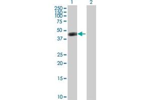 Western Blot analysis of ASL expression in transfected 293T cell line by ASL MaxPab polyclonal antibody. (ASL anticorps  (AA 1-464))