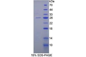 SDS-PAGE (SDS) image for Keratin 8 (KRT8) (AA 92-393) protein (His tag) (ABIN1080167) (KRT8 Protein (AA 92-393) (His tag))