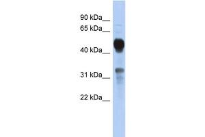 WB Suggested Anti-MVK Antibody Titration: 0. (MVK anticorps  (Middle Region))