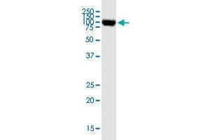 OPA1 monoclonal antibody (M02), clone 8A20. (OPA1 anticorps  (AA 851-960))