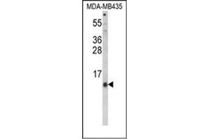 Western blot analysis of Hepcidin / HAMP Antibody (Center) in MDA-MB435 cell line lysates (35ug/lane). (Hepcidin anticorps  (Middle Region))