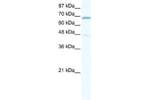 WB Suggested Anti-CACNB2 Antibody Titration:  0. (CACNB2 anticorps  (C-Term))