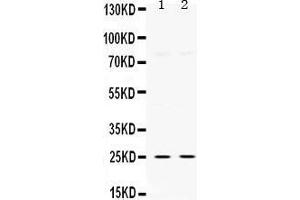 Western Blotting (WB) image for anti-Thymidine Kinase 1, Soluble (TK1) (AA 2-234) antibody (ABIN3042478) (TK1 anticorps  (AA 2-234))