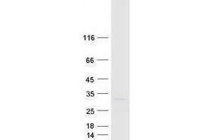Validation with Western Blot